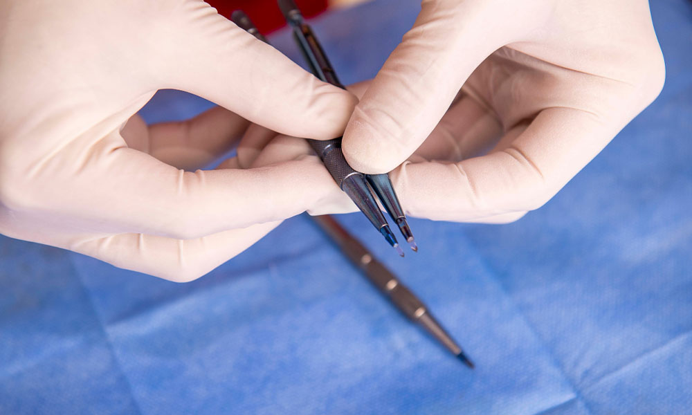 Saffier Haartransplantatie