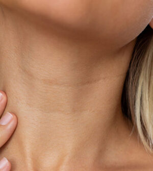 Pigmentvlekken op het Hals