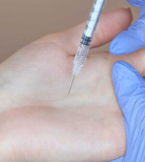 Overmatig Zweten Handen Botox