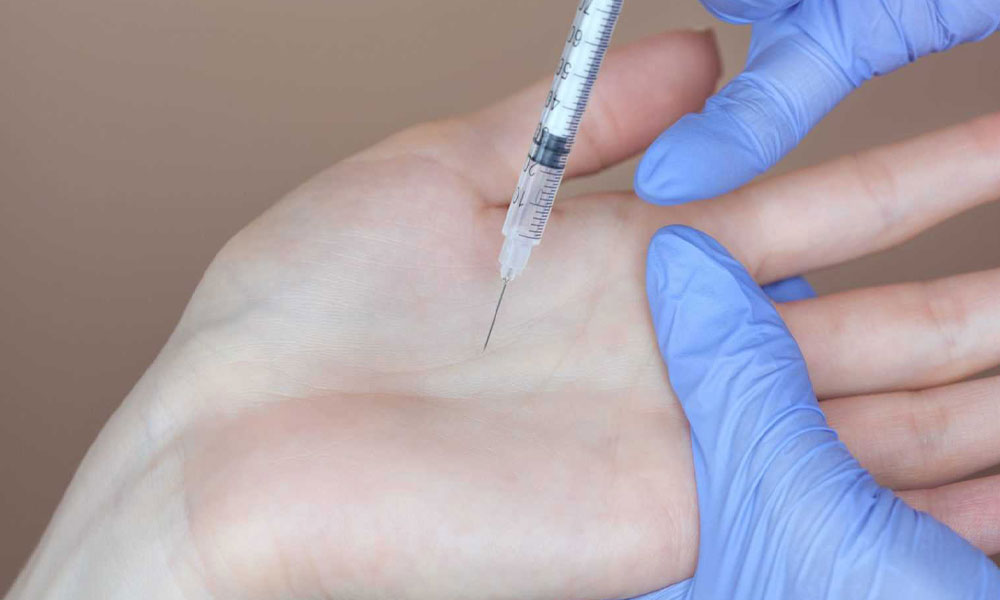 Overmatig Zweten Handen Botox