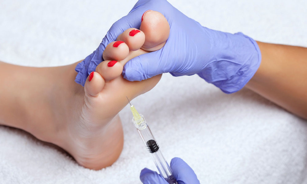 Overmatig Zweten Voeten Botox