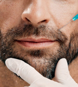 PRP Behandeling Baard