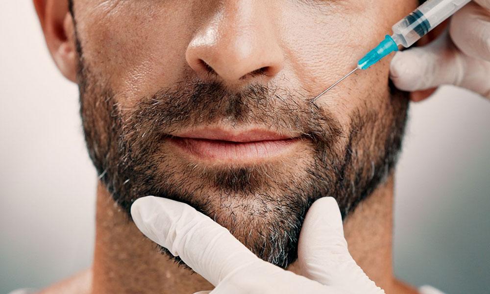 PRP Behandeling Baard