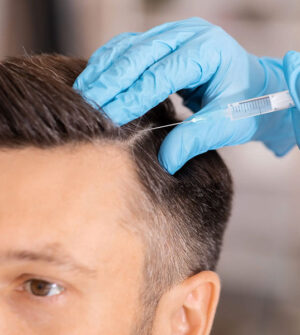 PRP Behandeling Haar