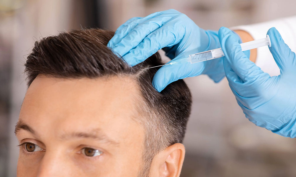 PRP Behandeling Haar