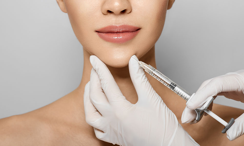 Radiesse Kaaklijn Fillers