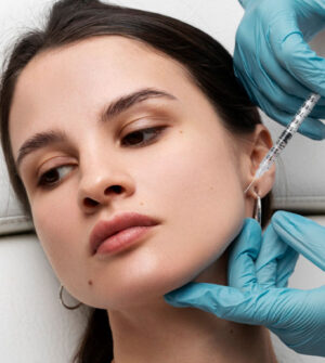 Radiesse Kin Fillers