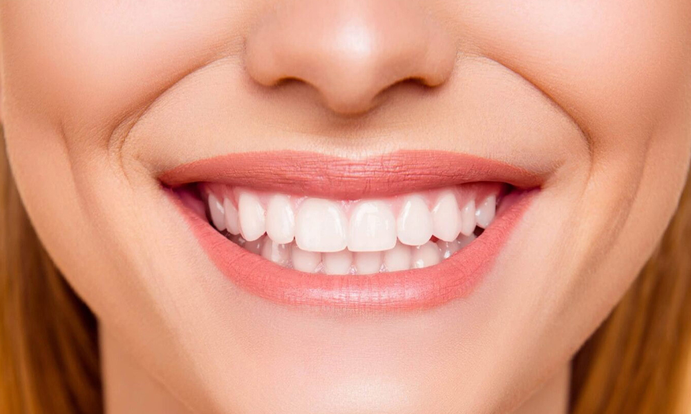 Curettage (Diepe Reiniging van het Tandvlees)