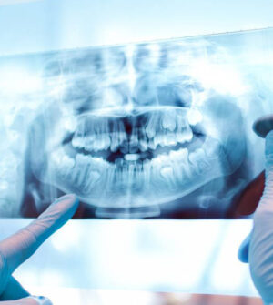 Panoramische en Digitale Röntgen