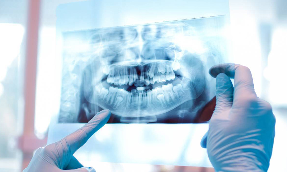 Panoramische en Digitale Röntgen