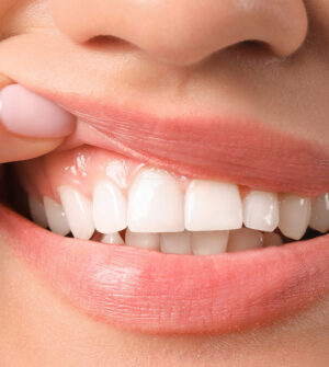 Parodontale Behandelingen (Tandvleesbehandelingen)