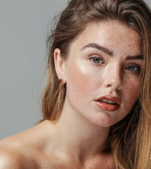 Pigmentvlekken Verwijderen