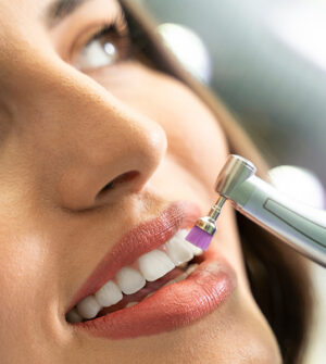 Tandpolijsten (Polijsten van het Tandoppervlak)