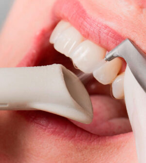 Tandreiniging met Airflow