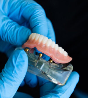 Vaste Prothese (Kronen en Bruggen)