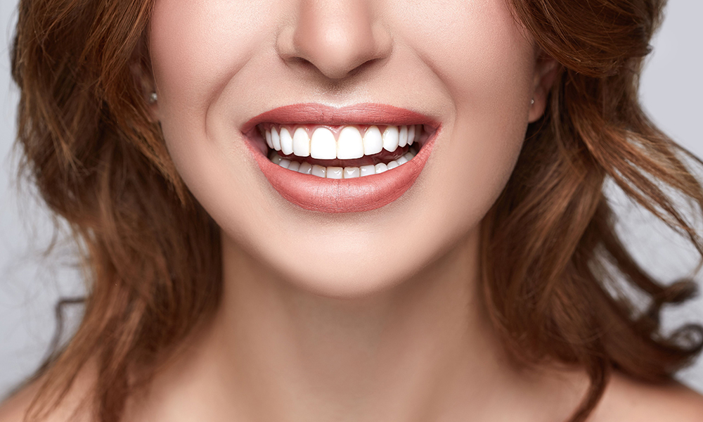 Wortelkanaalbehandeling van een Meerwortelige Tand