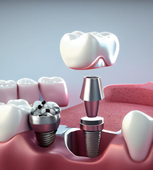 Implantaatbehandeling